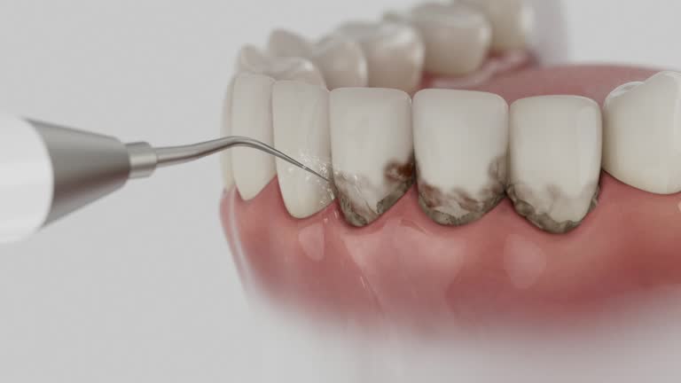 Reliable Dental contractor in Volo, IL by Smile Center Dentistry